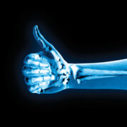 радиационна защита