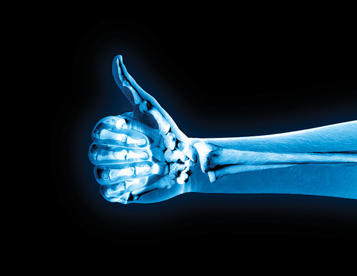 радиационна защита